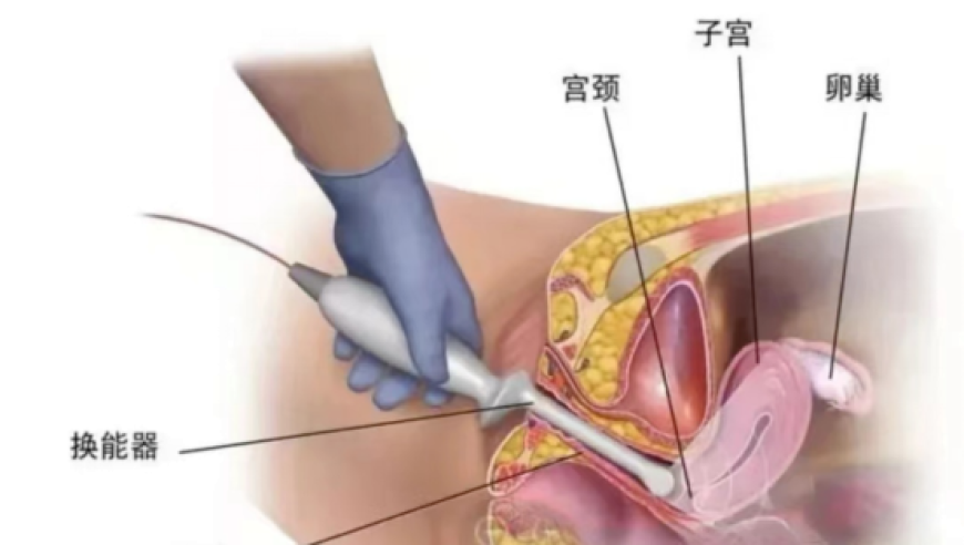 今晚必中三肖三,德外交部发视频嘲讽美泄密事件,决策资料解释落实_模拟版V8.51